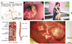 冉明医师创新国医精粹 铺就患者“健康之路” 开拓抗癌新路,突破绝症禁区。 中医世家三代秘技-扶正清毒抗癌疗法-中医肿瘤康复研究专家冉明