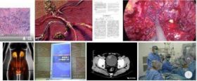 冉明医师创新国医精粹 铺就患者“健康之路” 开拓抗癌新路,突破绝症禁区。 中医世家三代秘技-扶正清毒抗癌疗法-中医肿瘤康复研究专家冉明