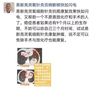 新冠病毒感染后，三高慢性炎症风湿病,肿瘤与结节增生药物治疗效果欠佳怎么办？