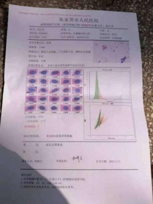 【特邀专家】治疗肿瘤第一人——陈吉香